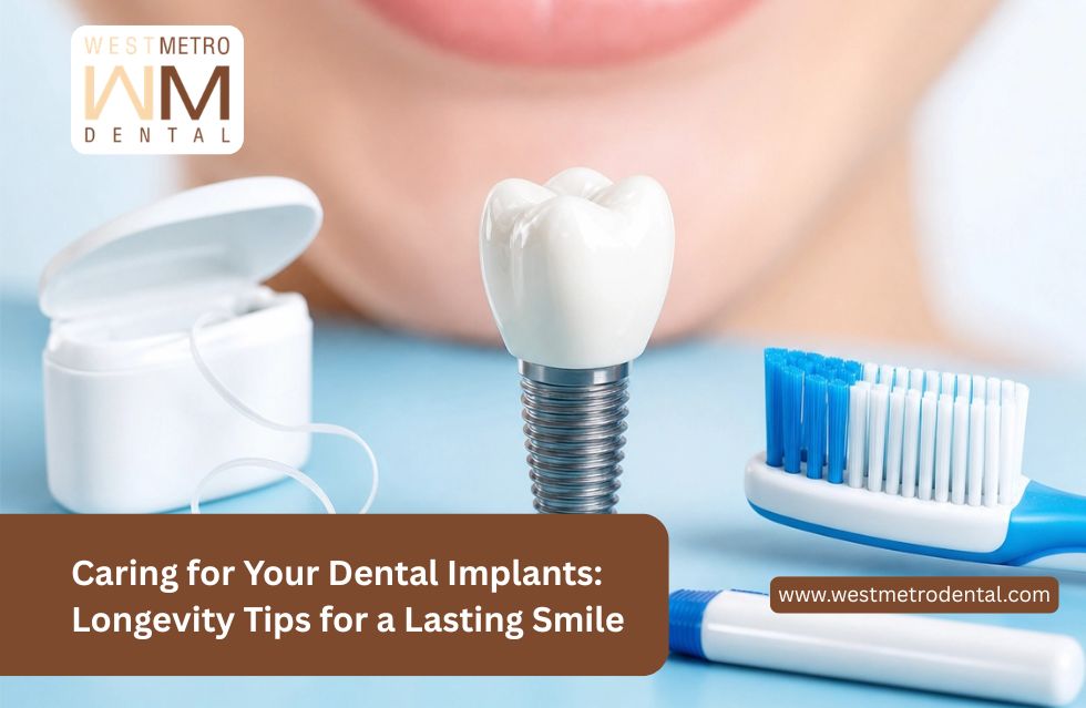 Caring for Your Dental Implants: Longevity Tips for a Lasting Smile